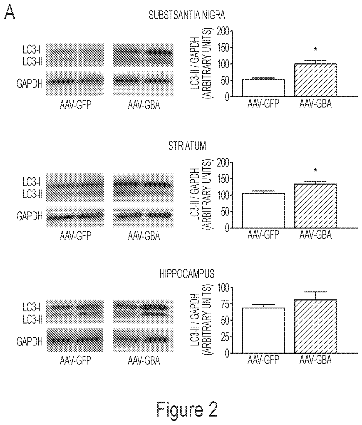 Glucocerebrosidase gene therapy for Parkinson's disease