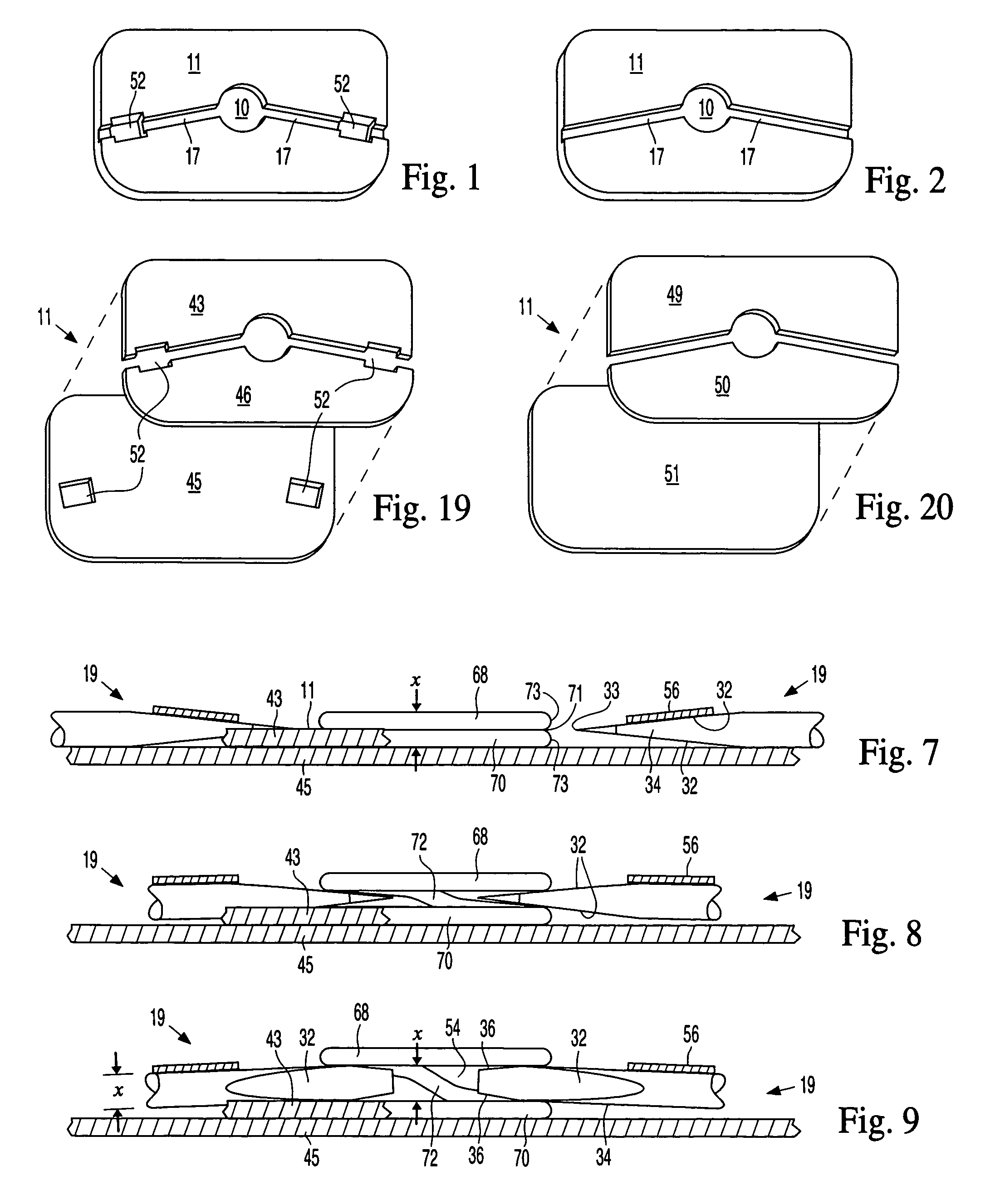 Split ring and pellet method stitchless fastener coil separation tool