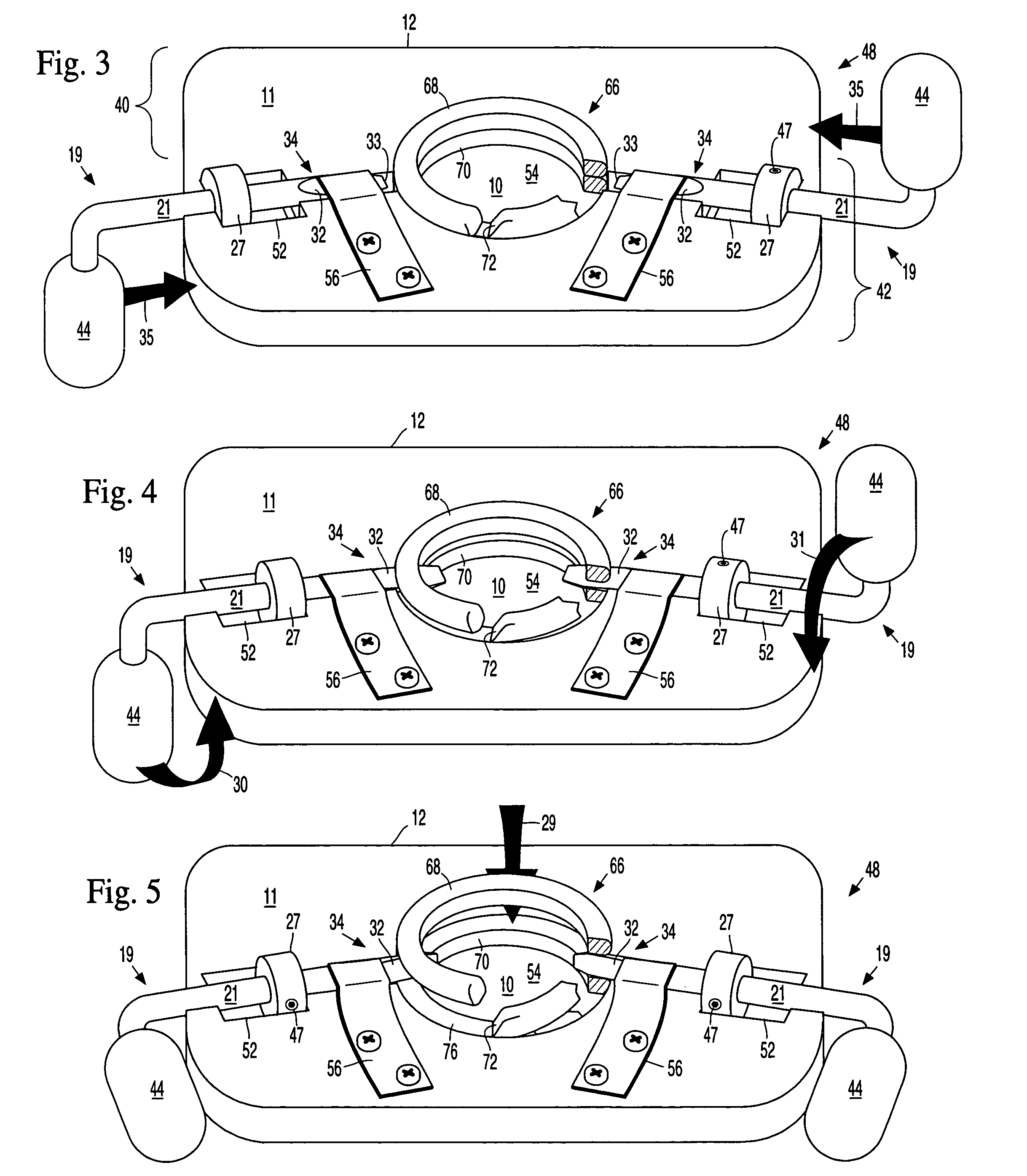 Split ring and pellet method stitchless fastener coil separation tool