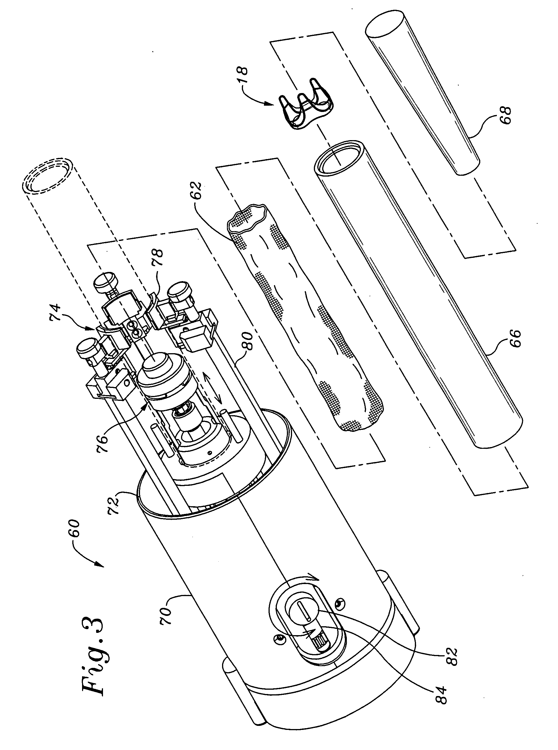 Systems and methods for assembling components of a fabric-covered prosthetic heart valve