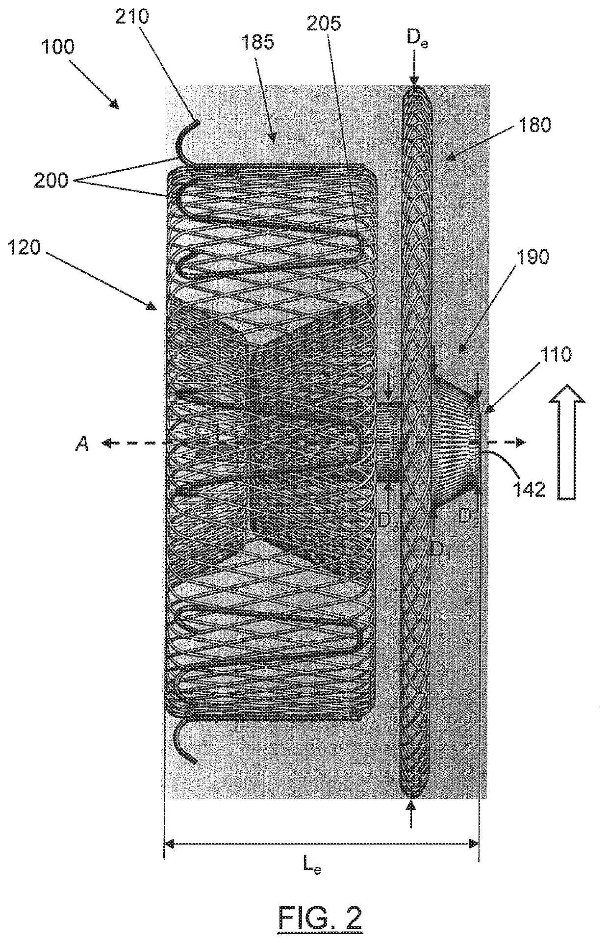 Percutaneous catheter directed intravascular occlusion devices with retractable stabilizing wires