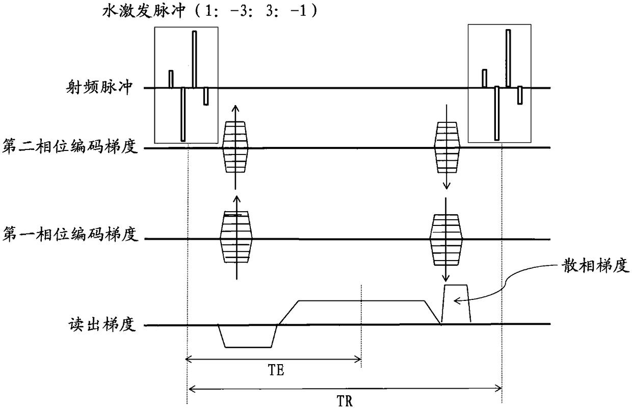 Deep-venous-thrombosis magnetic resonance imaging method and device, medium and computer equipment