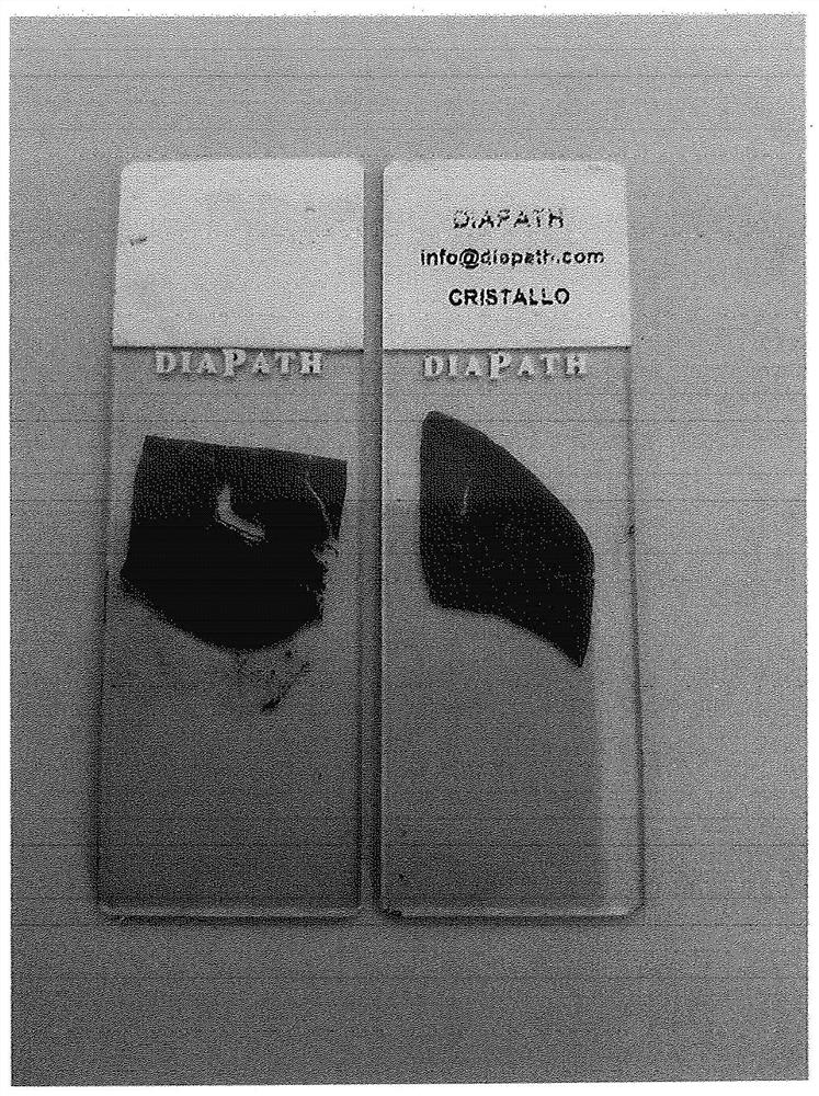 Method for the preparation of biological, cytological, histological and autopsical samples and composition for mounting microscope slides