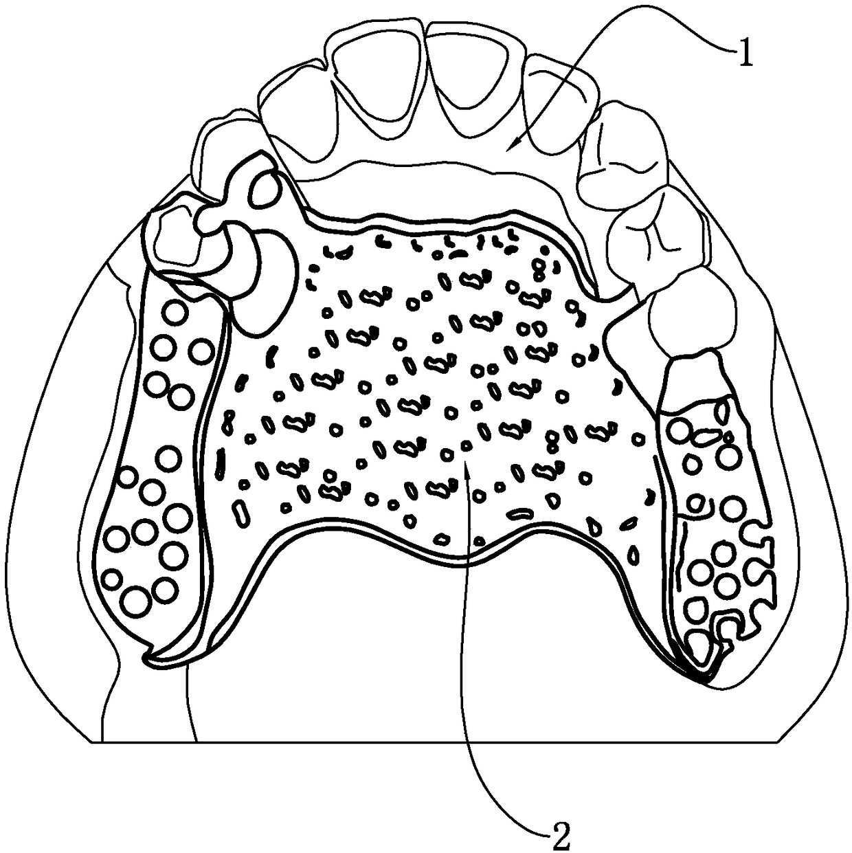 Manufacturing process of denture framework