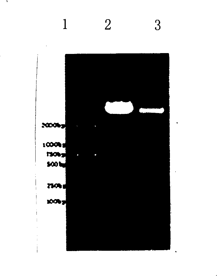 Low antigen recombination glucokinase mutant and its preparation method