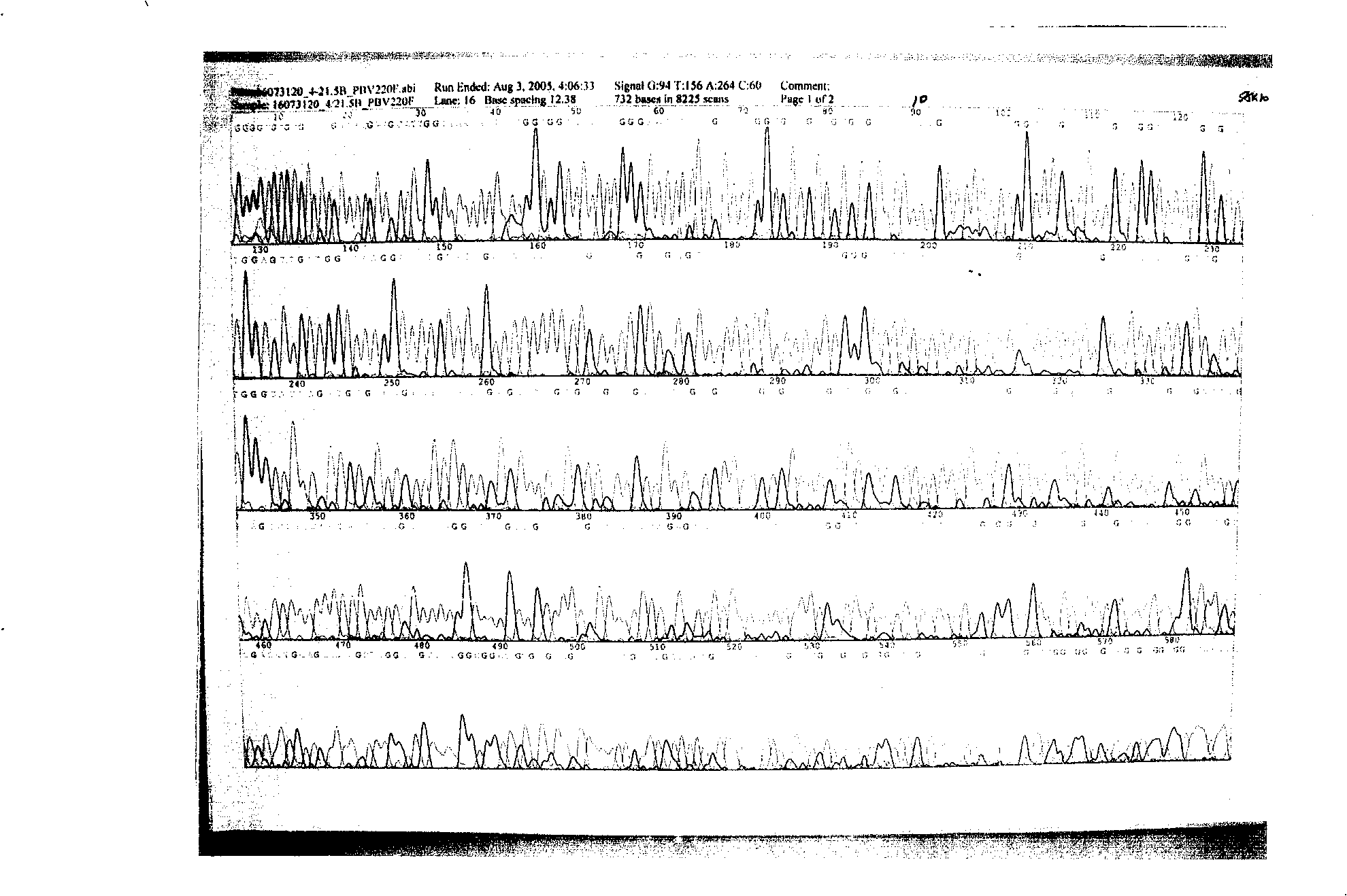 Low antigen recombination glucokinase mutant and its preparation method