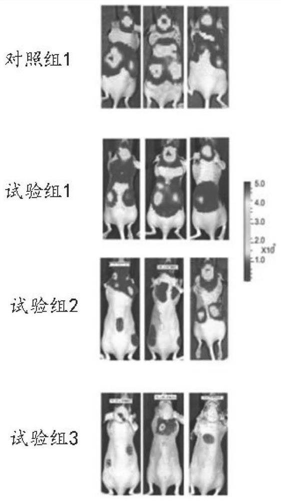 Application of medicine in preparation of drugs for treating metastatic encephaloma and related diseases thereof