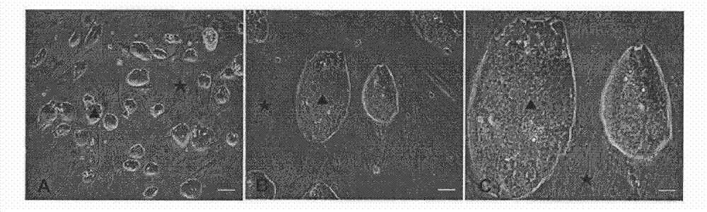 Method for differentiation of embryonic stem cells into nerve cells through in vitro induction