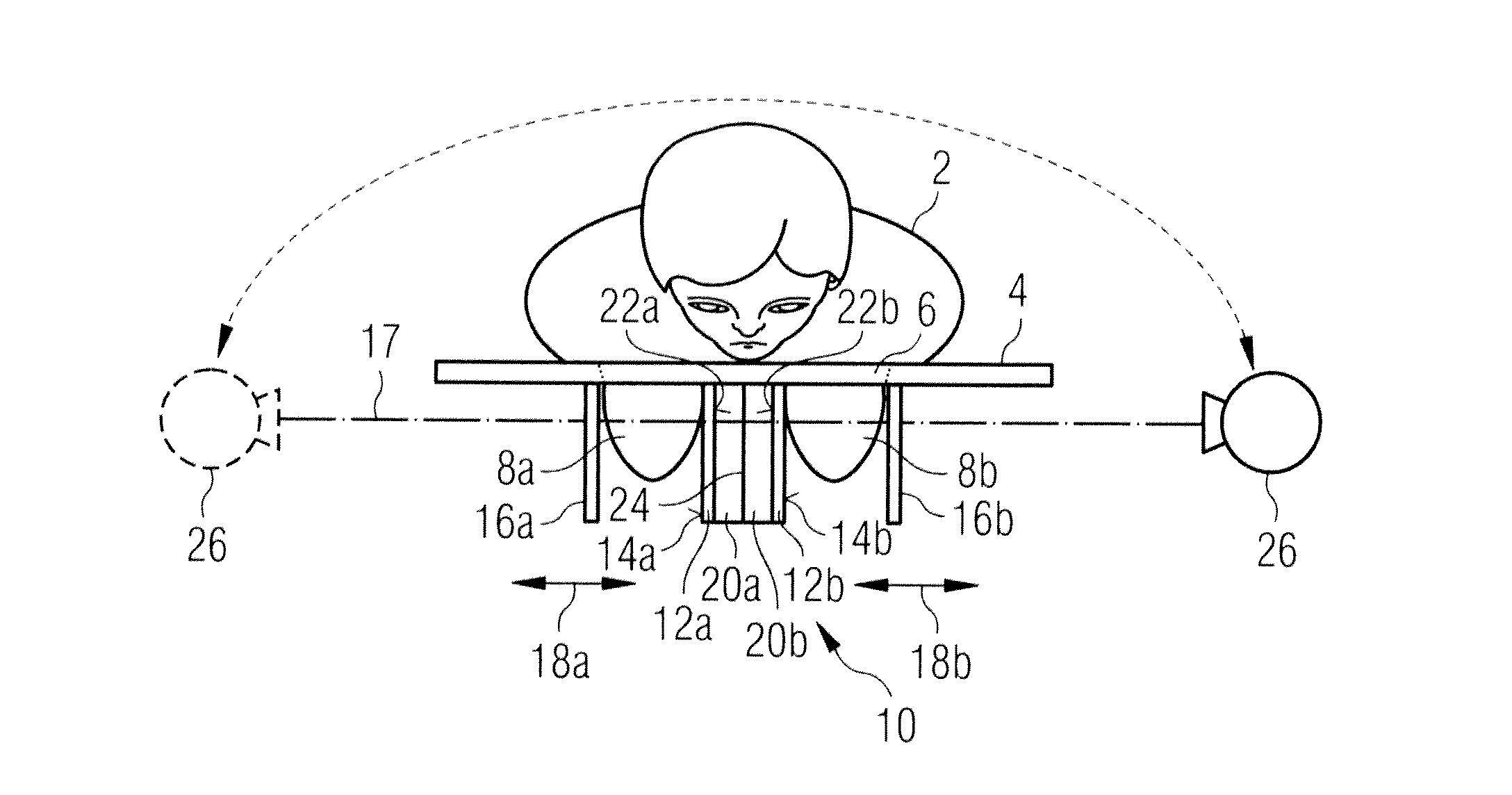 Mammography method and mammography apparatus