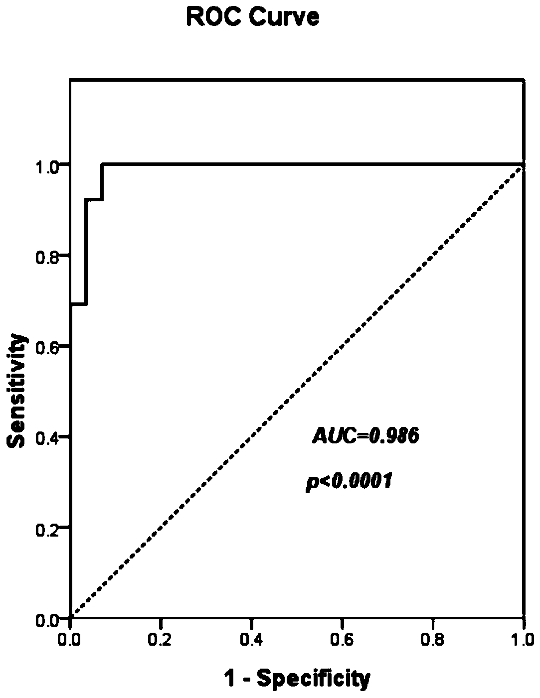 Glioma diagnostic marker circ6:22020339|22020542 and its application