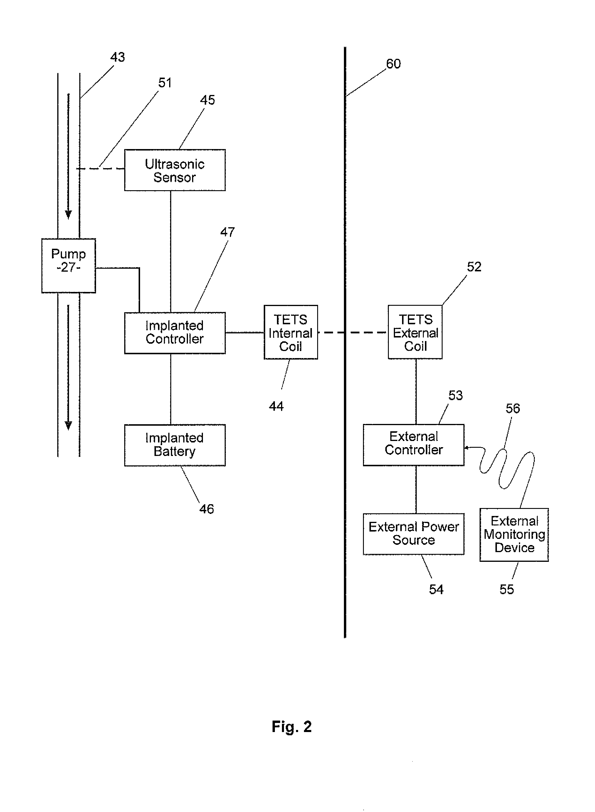 Blood Pump With An Ultrasonic Transducer