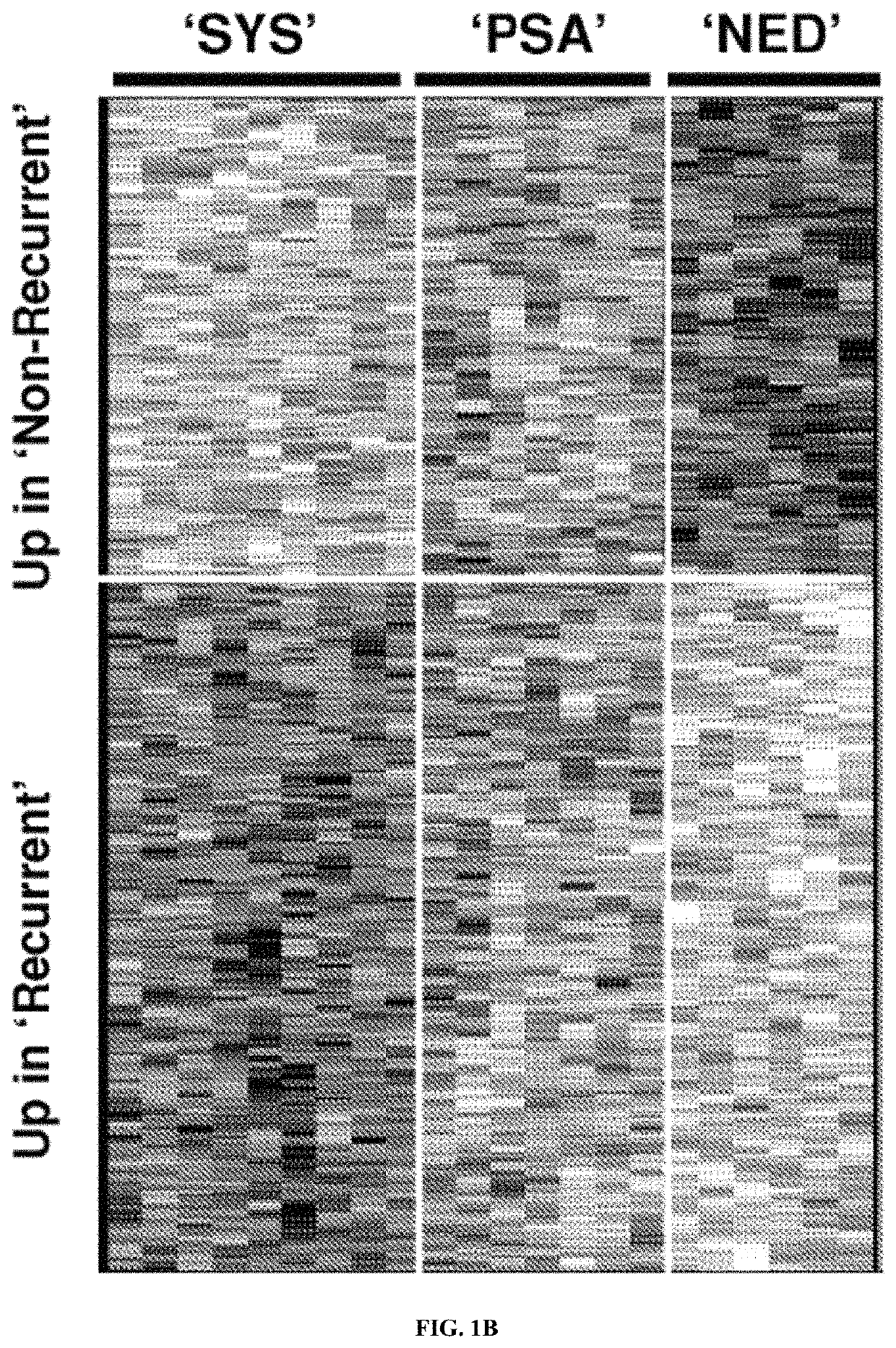 Systems and methods for expression-based discrimination of distinct clinical disease states in prostate cancer