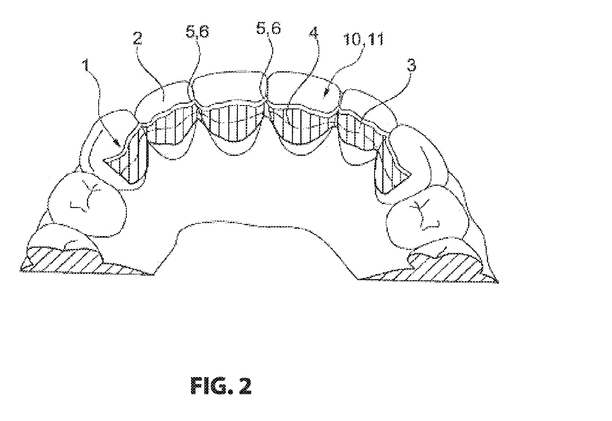 Retainer and method for production thereof