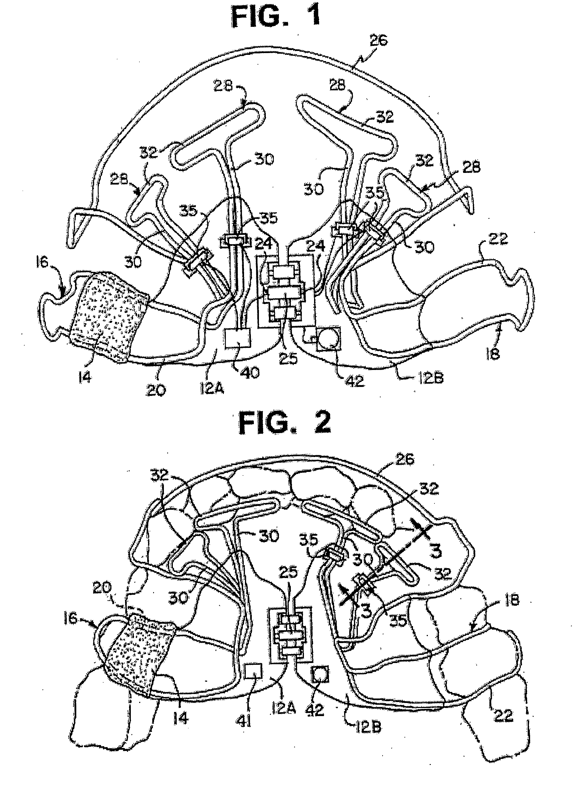 System and method to bioengineer facial form in adults