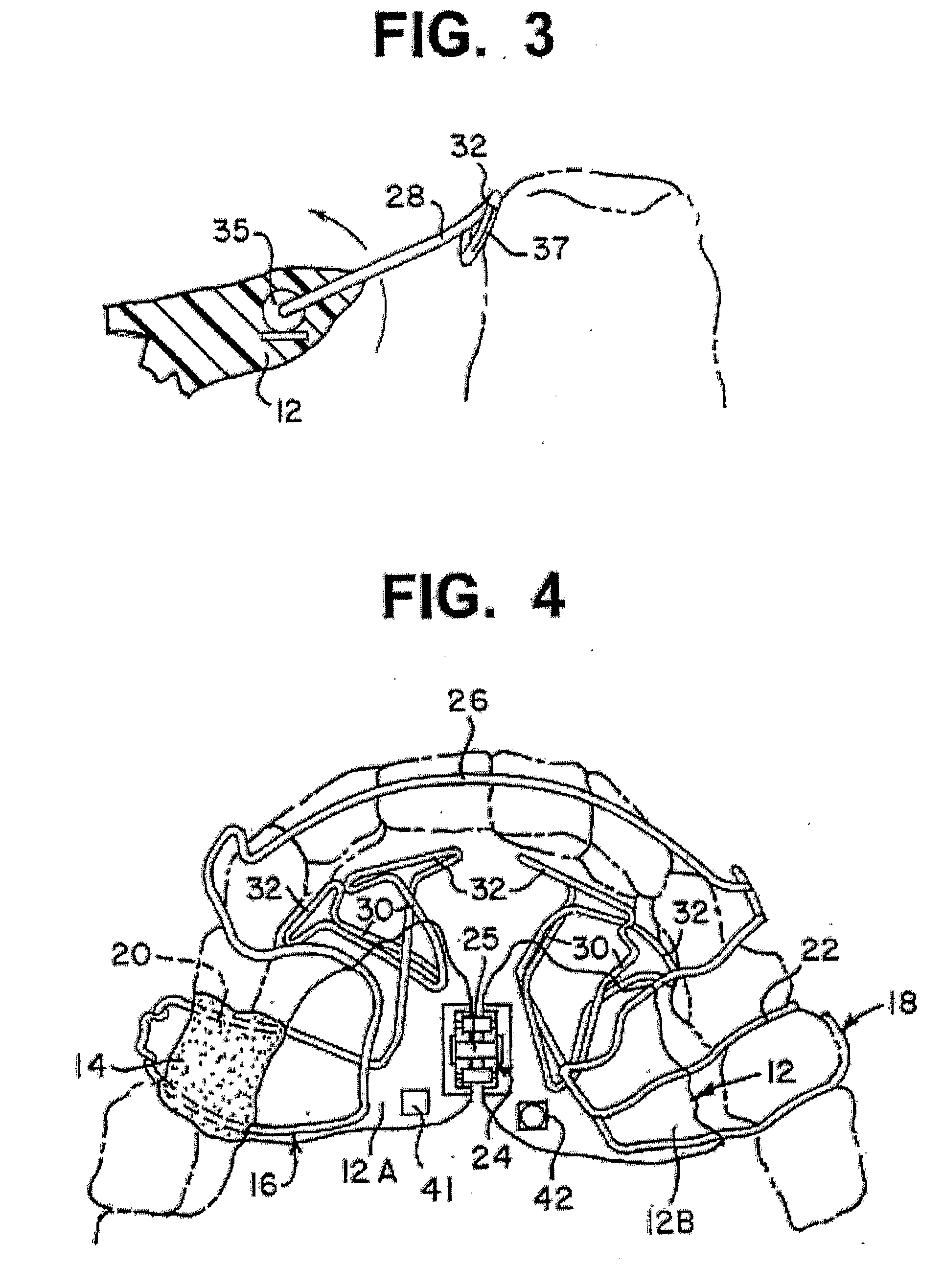 System and method to bioengineer facial form in adults