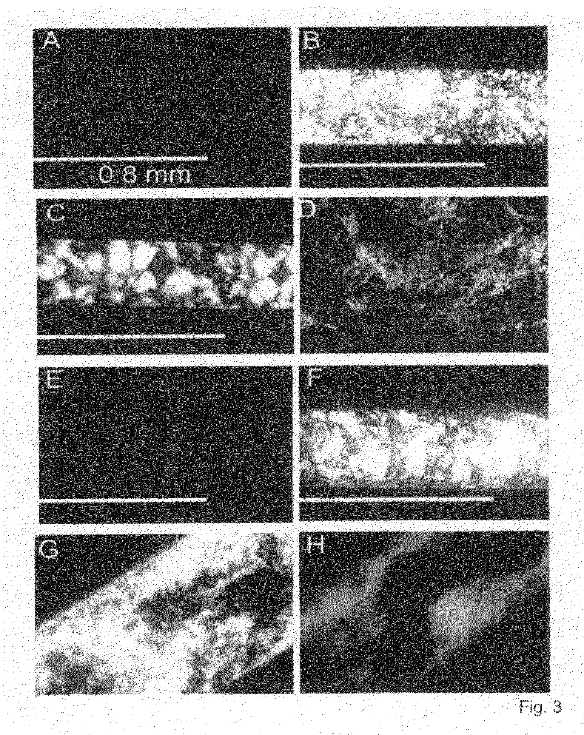 Beta-peptide lyotropic liquid crystals and methods of manufacture and use thereof