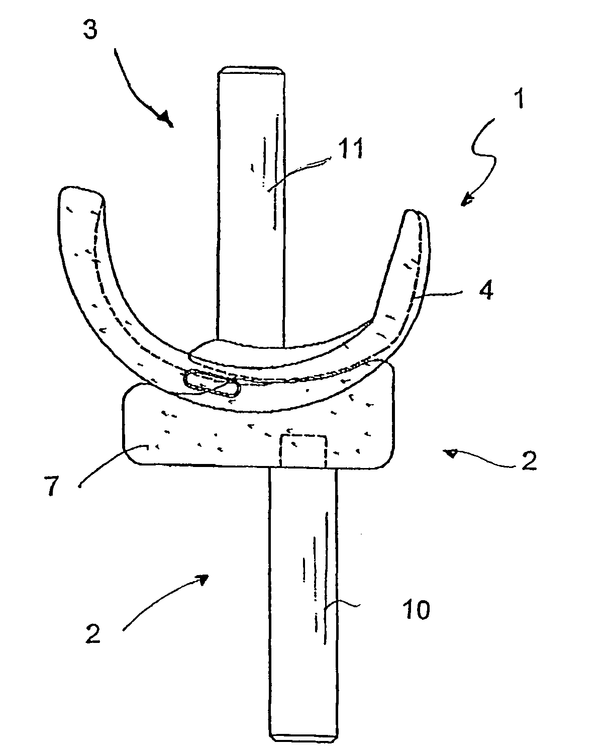 Disposable articulated spacing device for surgical treatment of joints of the human body