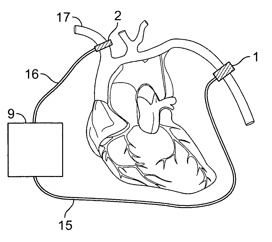 Method and device for counteracting hypotension