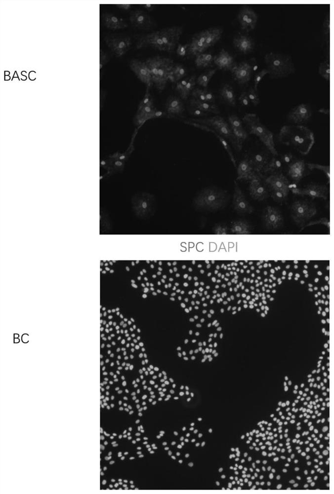 Culture medium and method for inducing airway basal stem cells to differentiate into bronchoalveolar stem cells