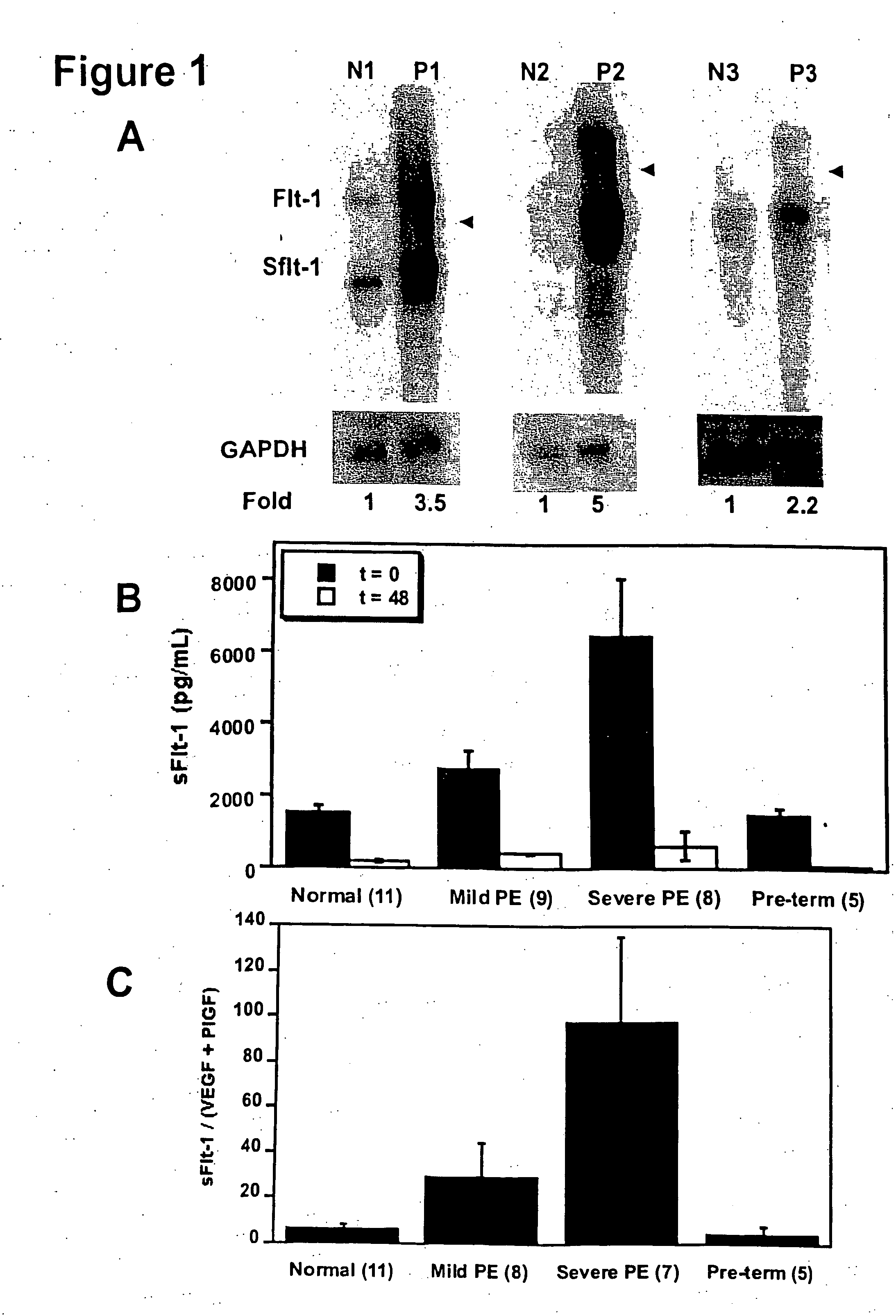 Methods of diagnosing and treating pre-eclampsia or eclampsia