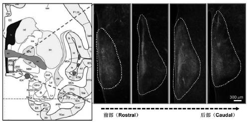 Construction method of gene overexpression chimeric animal model based on hNPY and hAgRP and application