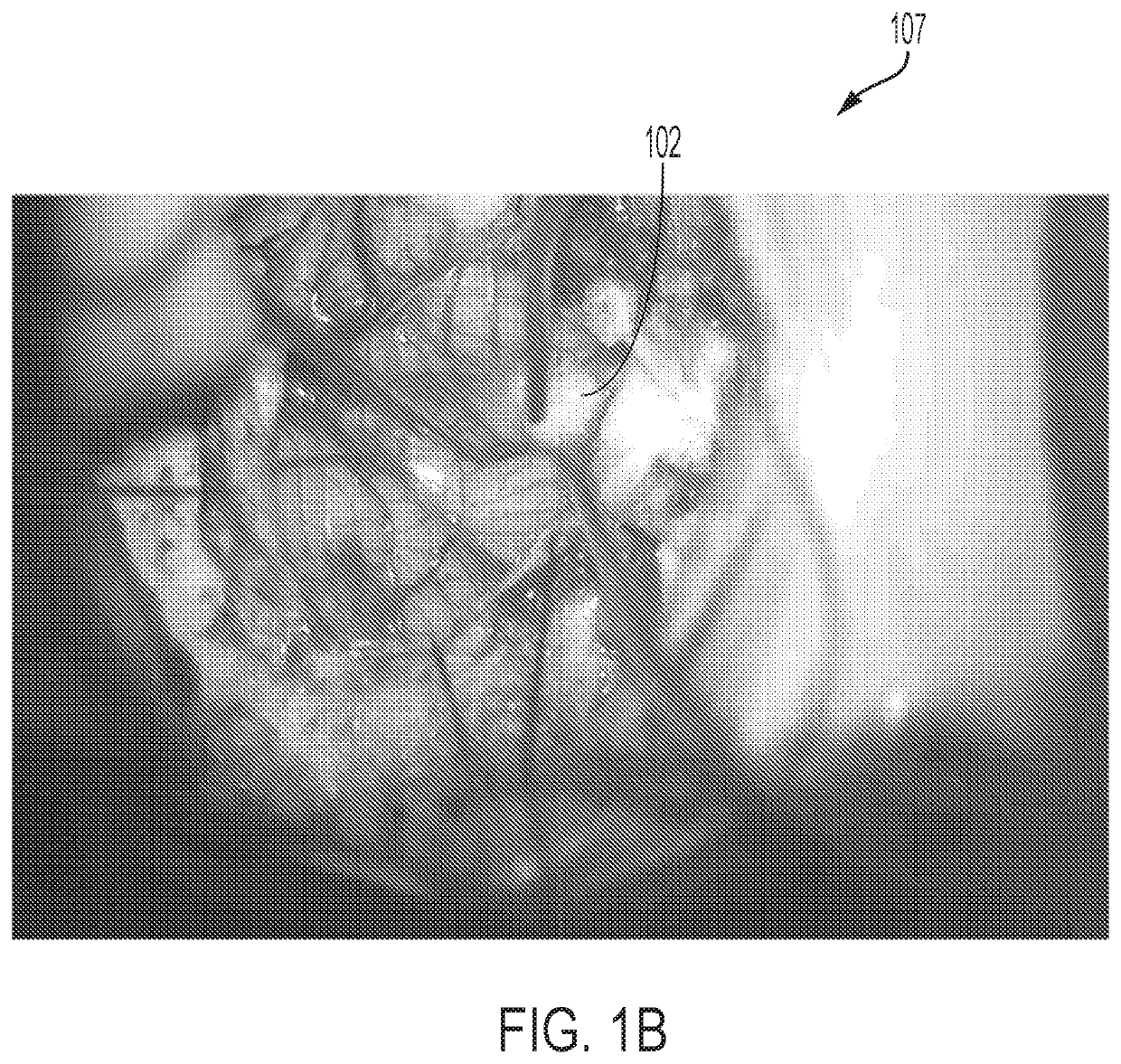 Systems and methods for simultaneous near-infrared light and visible light imaging