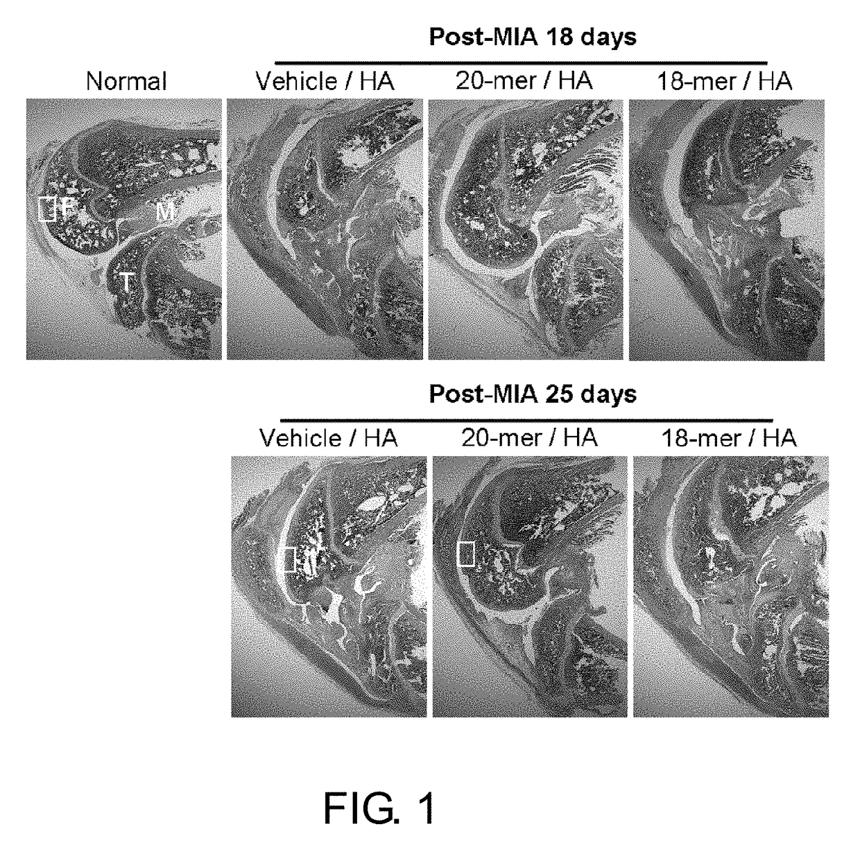 Use of PEDF-derived polypeptides for treating osteoarthritis