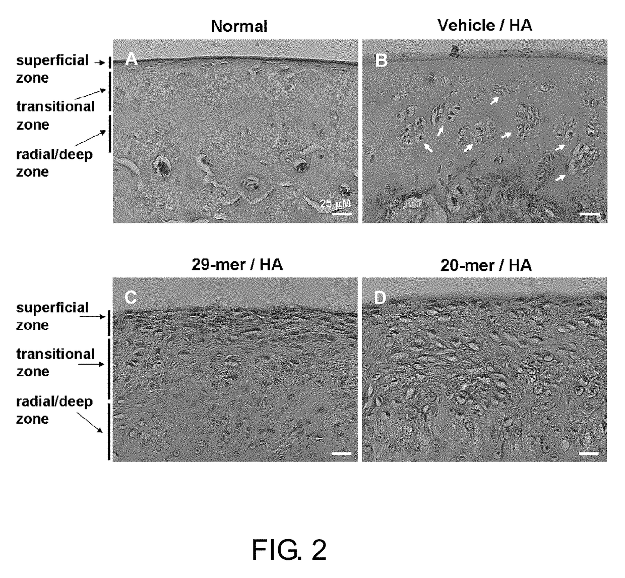 Use of PEDF-derived polypeptides for treating osteoarthritis