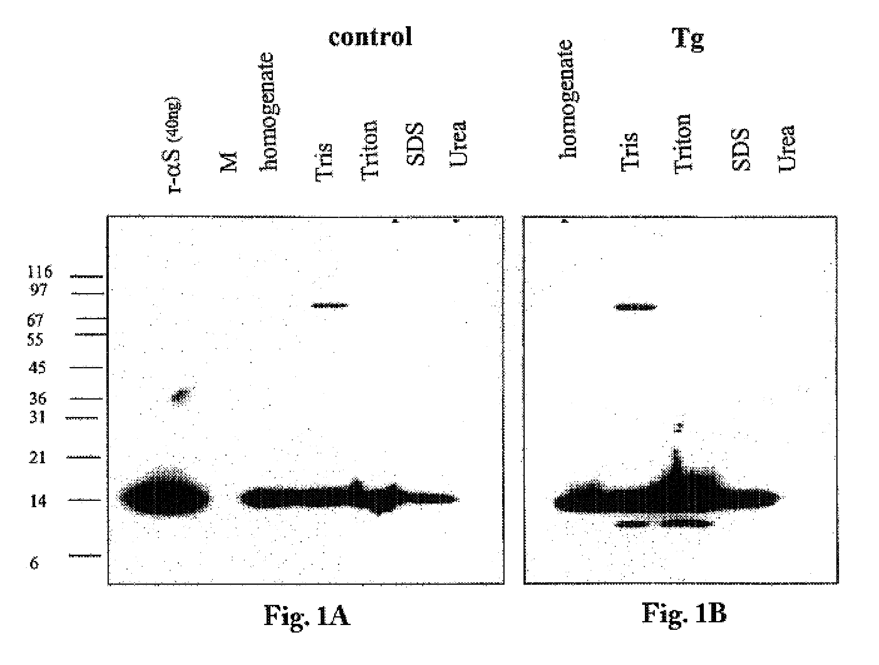 Truncated fragments of alpha-synuclein in Lewy body disease