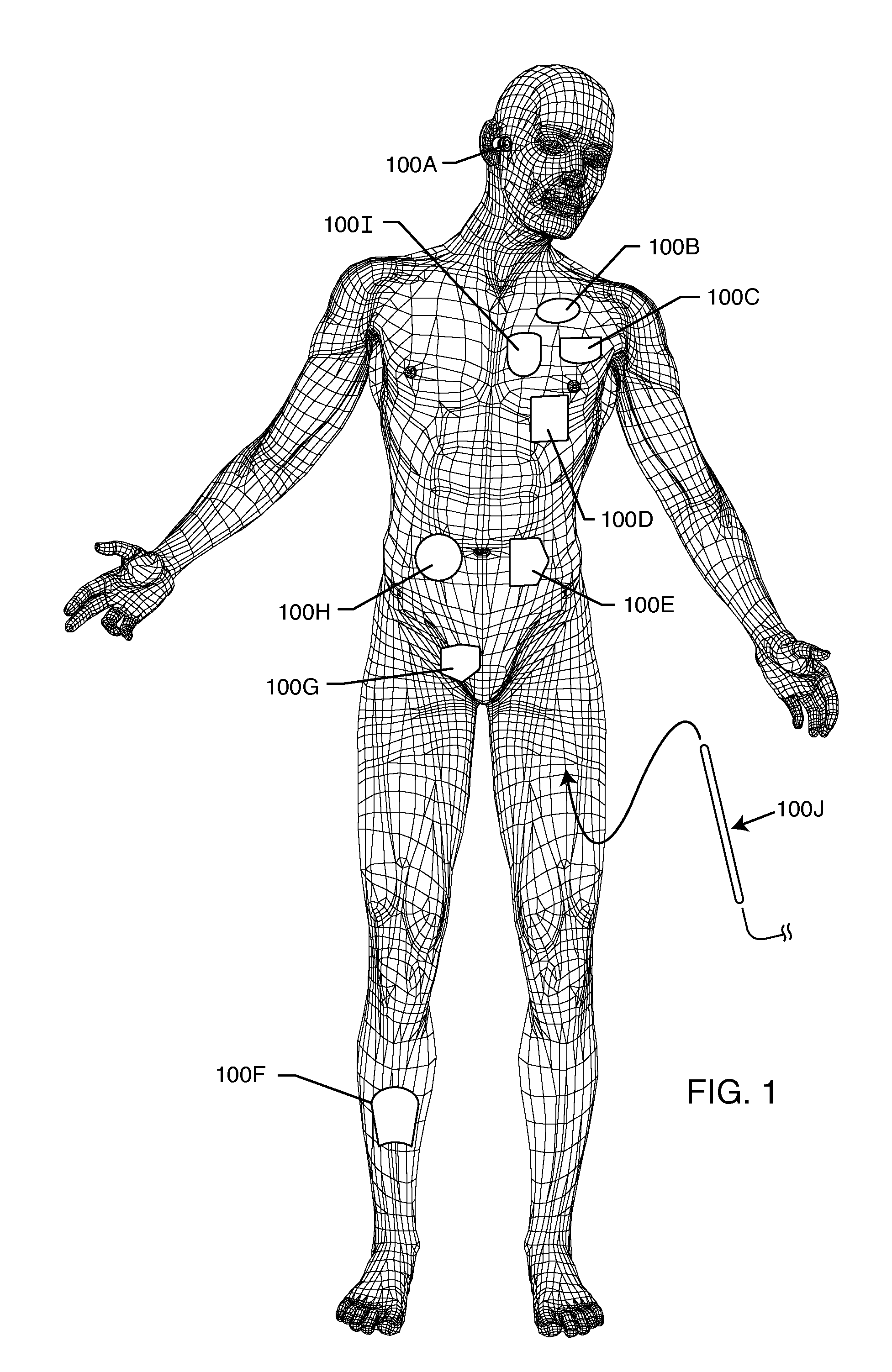 Implantable lead for an active medical device having an inductor design minimizing eddy current losses