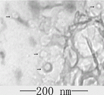 Preparation of mesenchymal stem cells (MSCs) derived exosomes and application of the same in acute lung injury