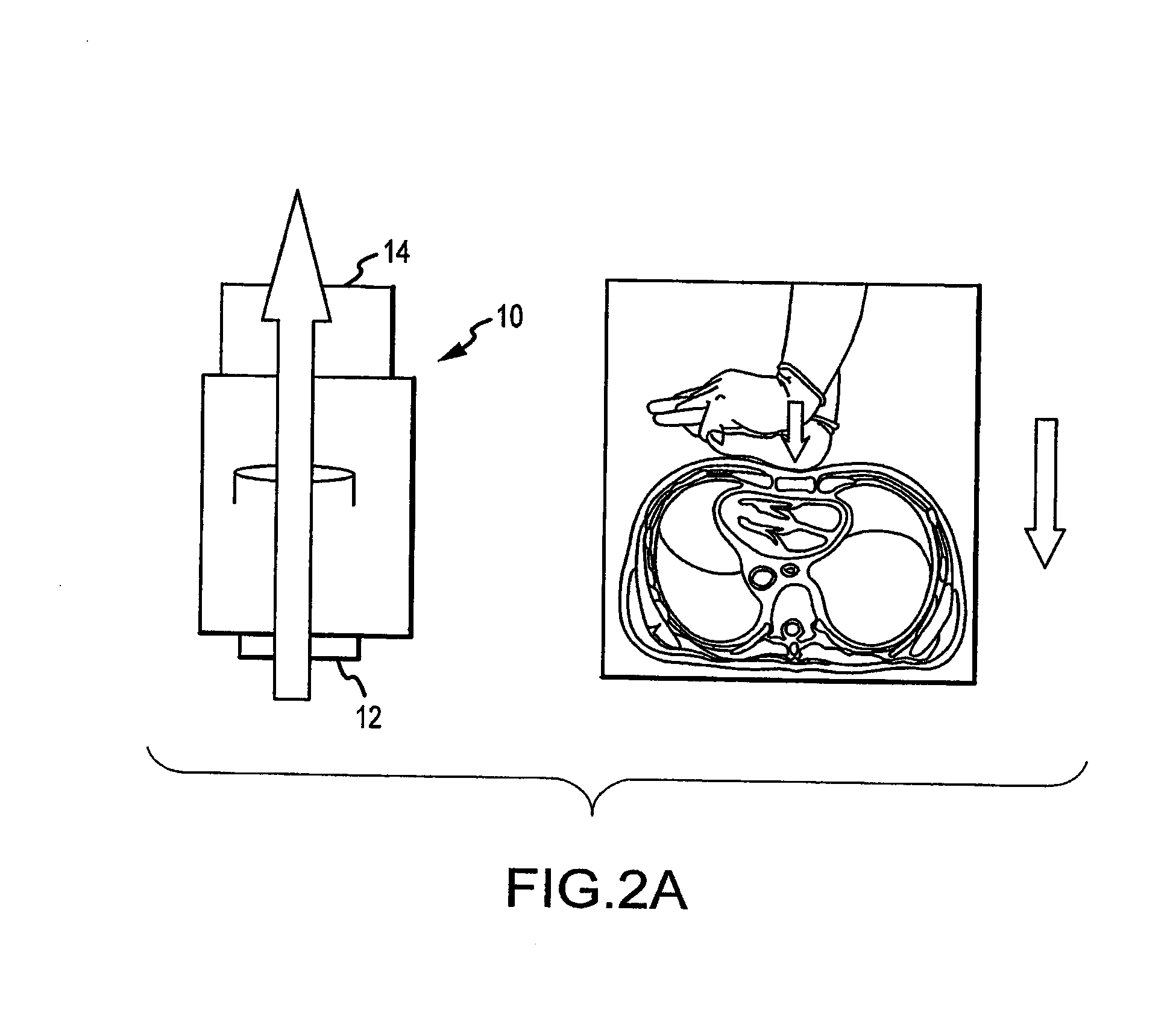 Systems and methods to increase survival with favorable neurological function after cardiac arrest