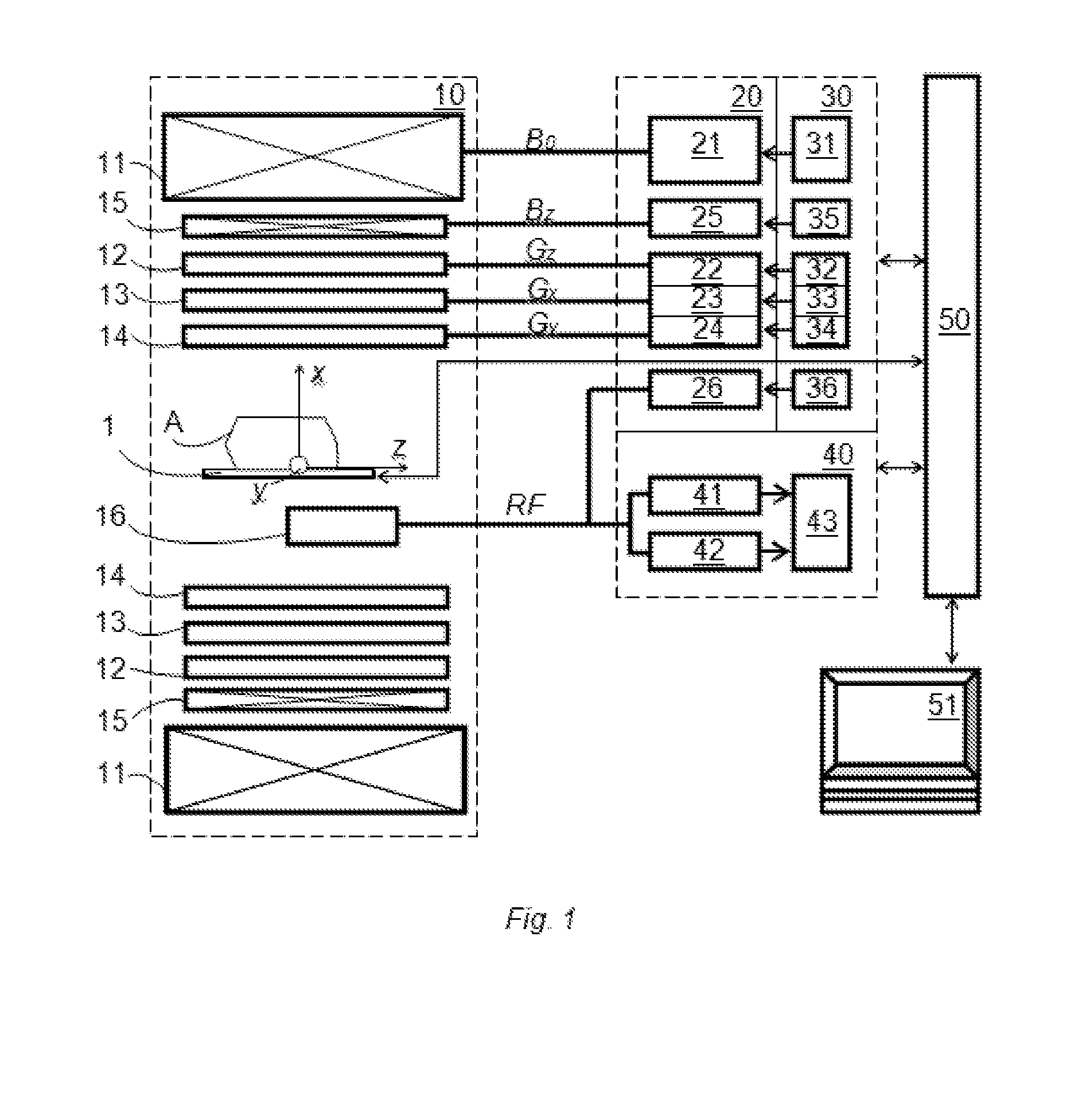 Method and apparatus for magnetic resonance imaging