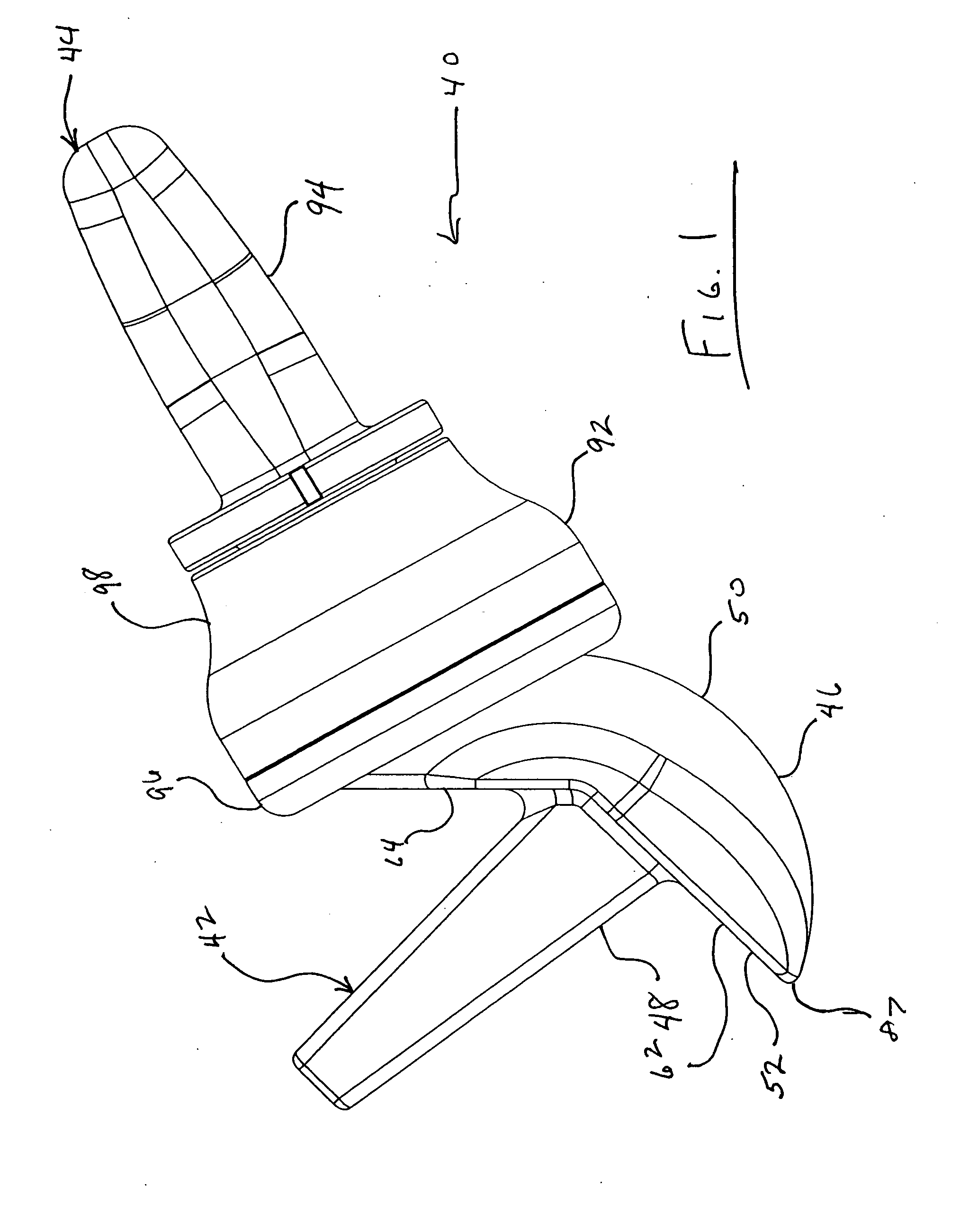 Radial-capitellar implant