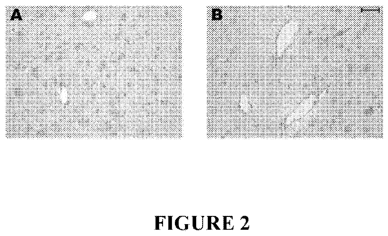 Method for preventing and/or treating chronic traumatic encephalopathy-I