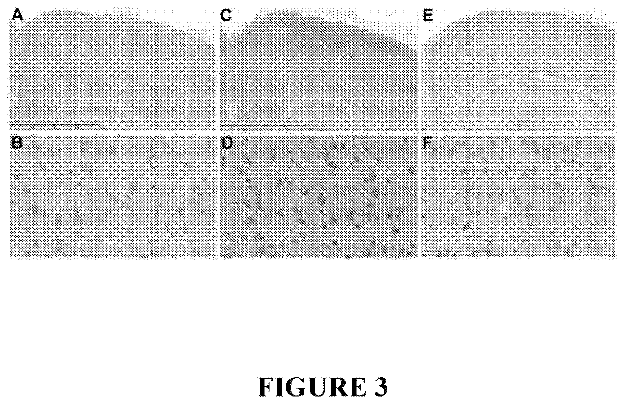 Method for preventing and/or treating chronic traumatic encephalopathy-I