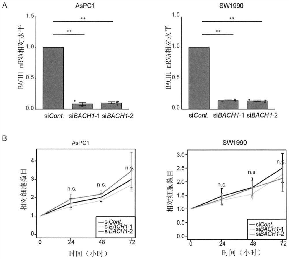 Novel marker of epithelial-mesenchymal transition in pancreatic cancer