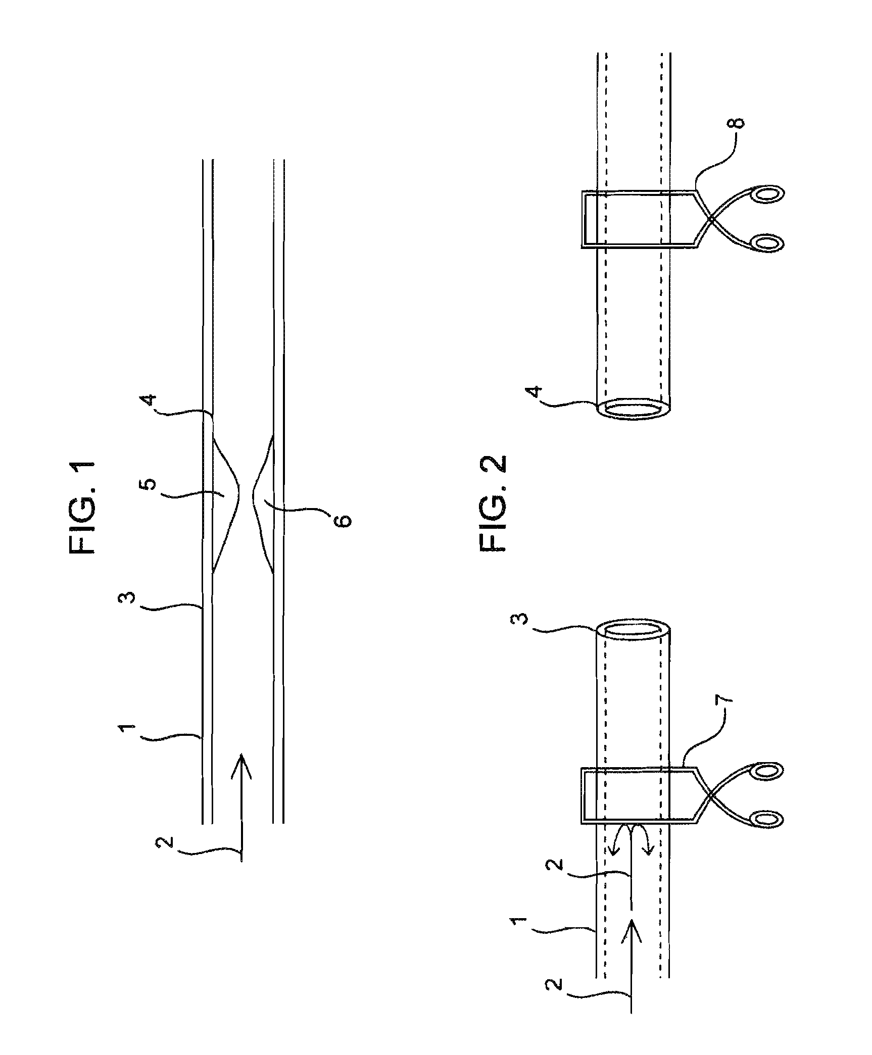 Compositions and methods for joining non-conjoined lumens