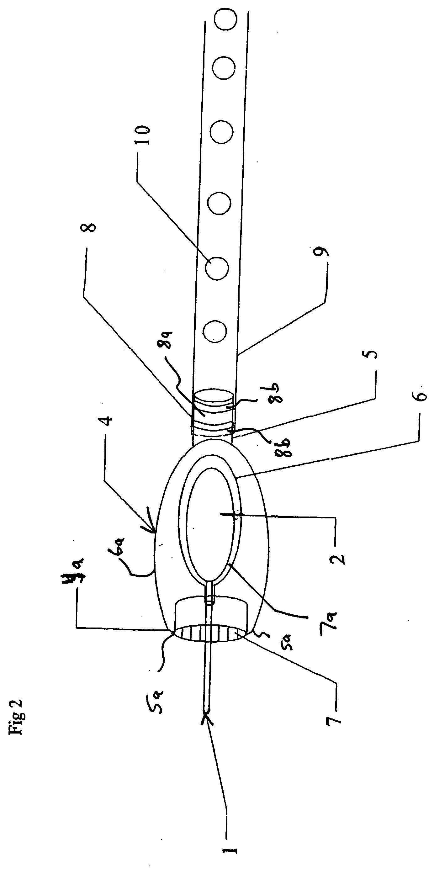 Method of stripping diseased blood vessels from the human body