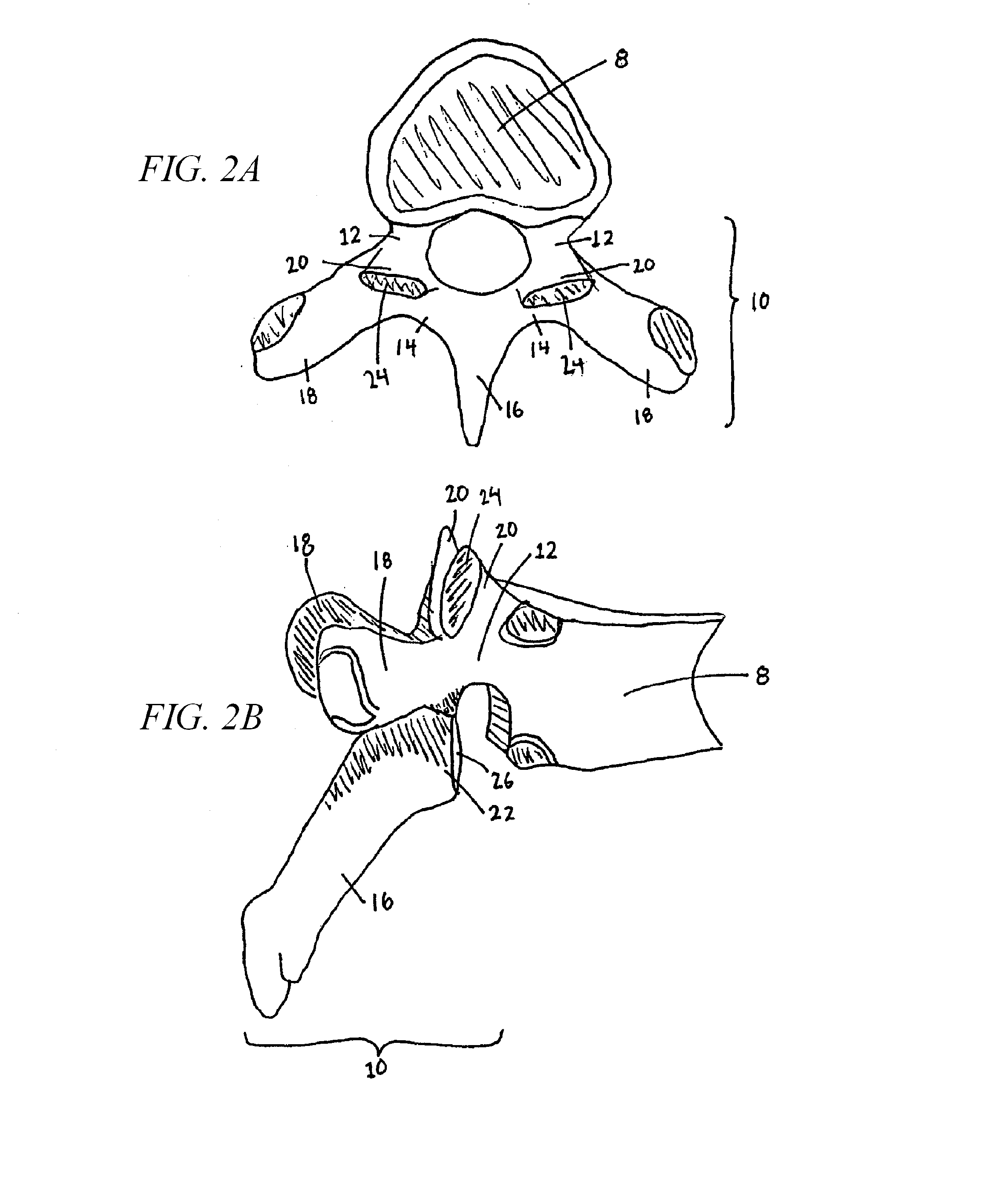 Method of using a vertebral facet joint drill