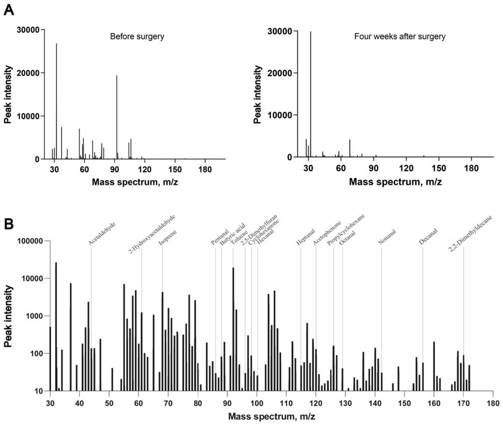 HPPI-TOFMS-based early-stage lung cancer diagnosis expiratory gas marker screening and application thereof