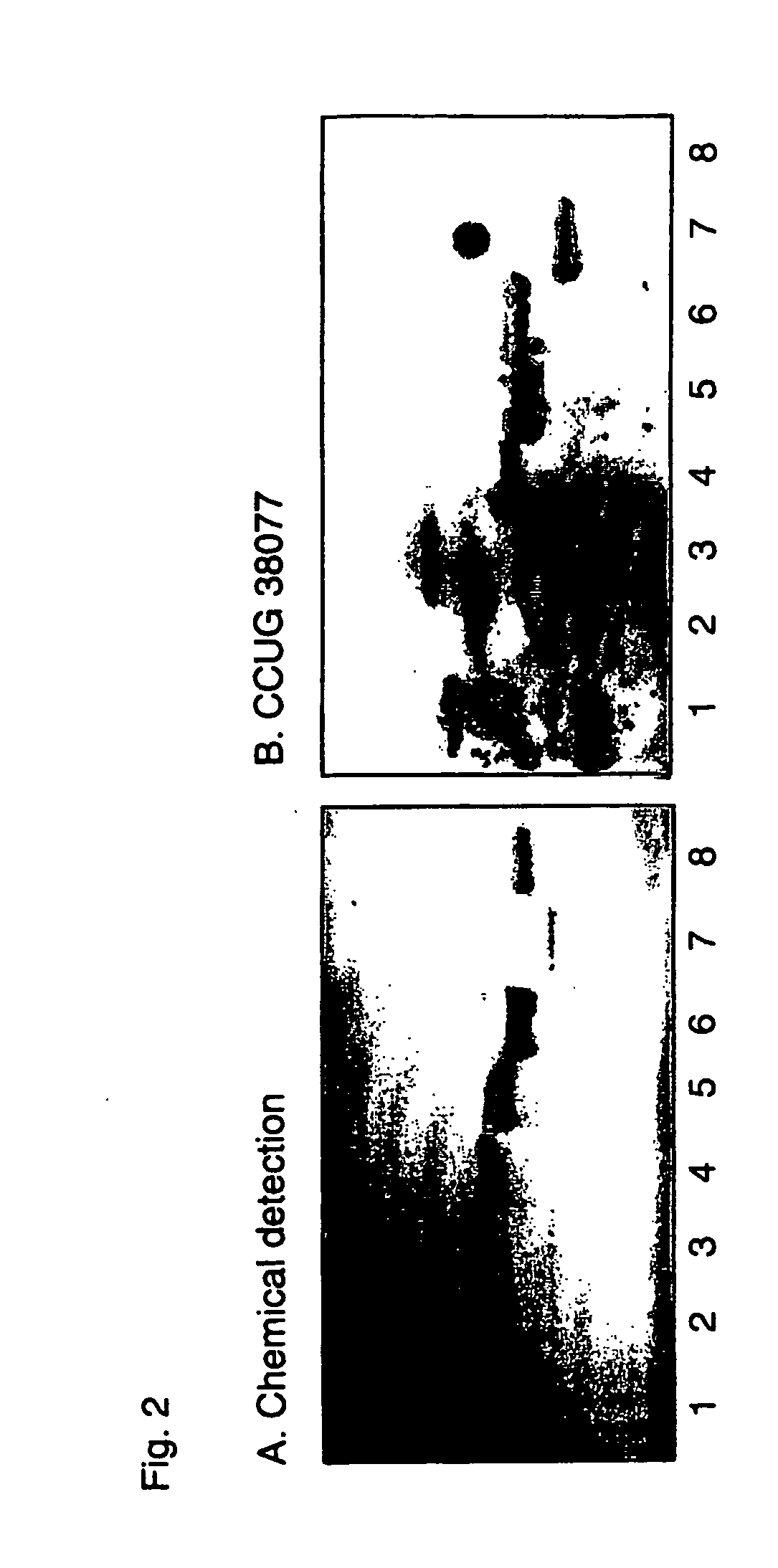 Therapeutic compositions for use in prophylaxis or treatment of diarrheas