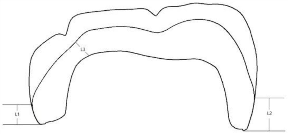 All-ceramic tooth production method