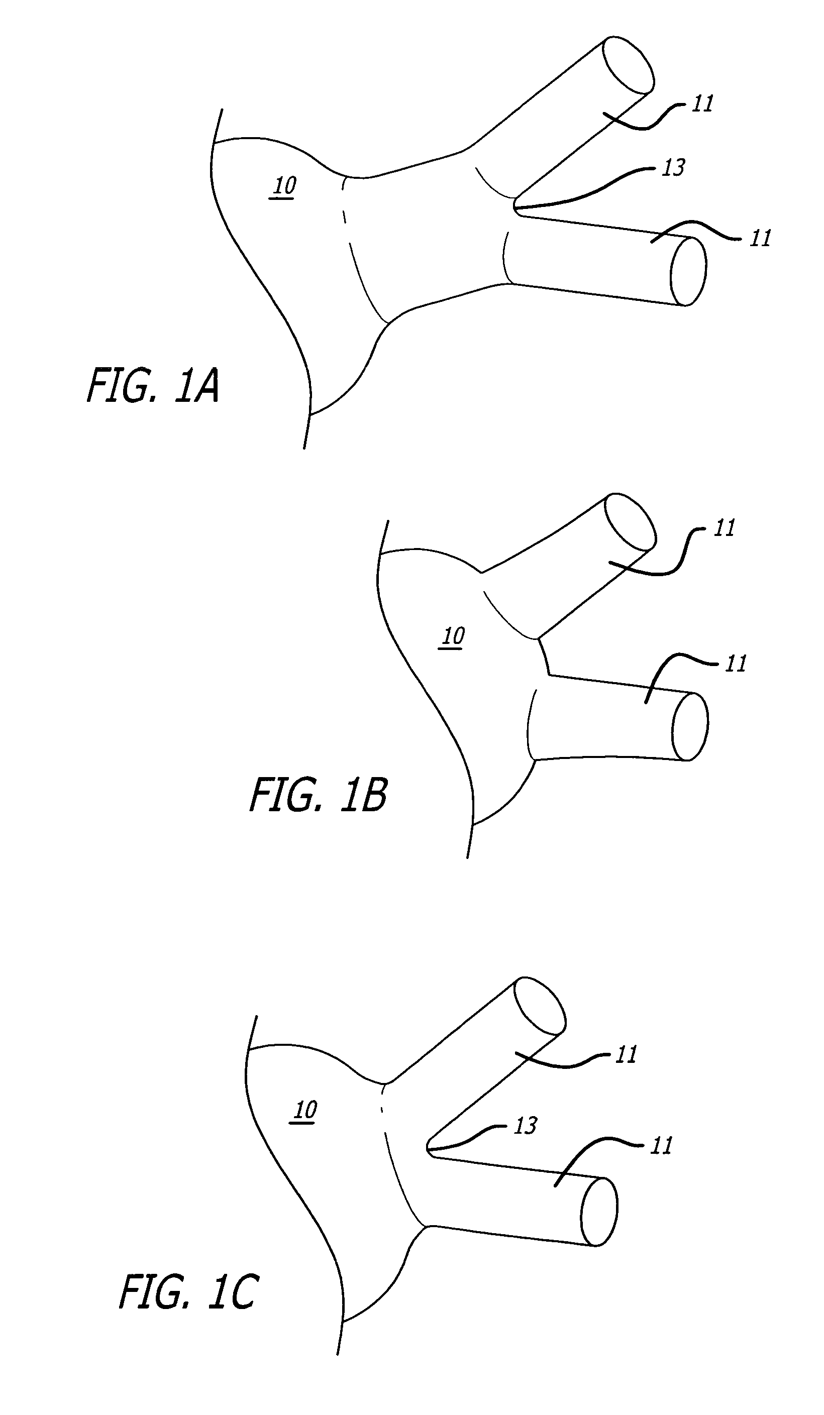 Electrical conduction block implant device