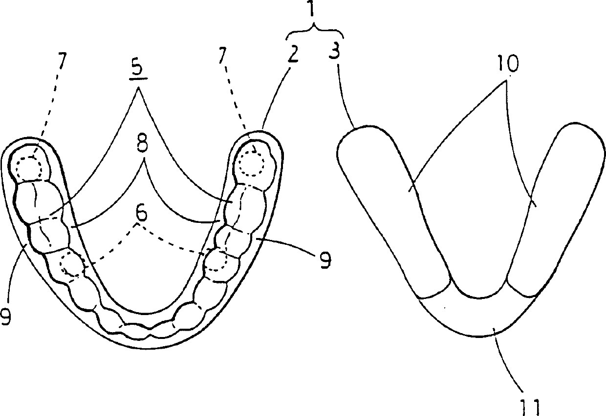 Mouthpiece