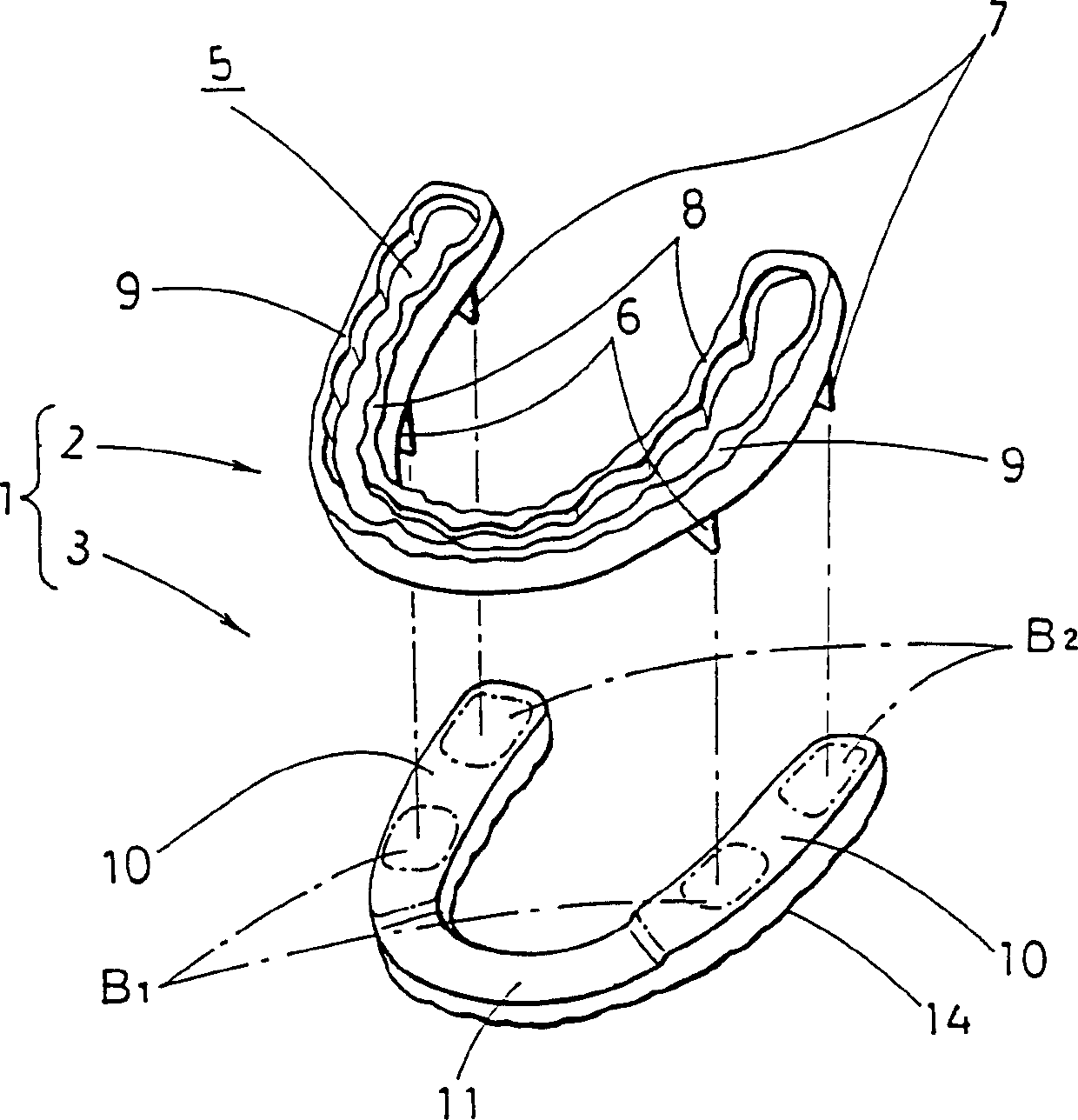 Mouthpiece