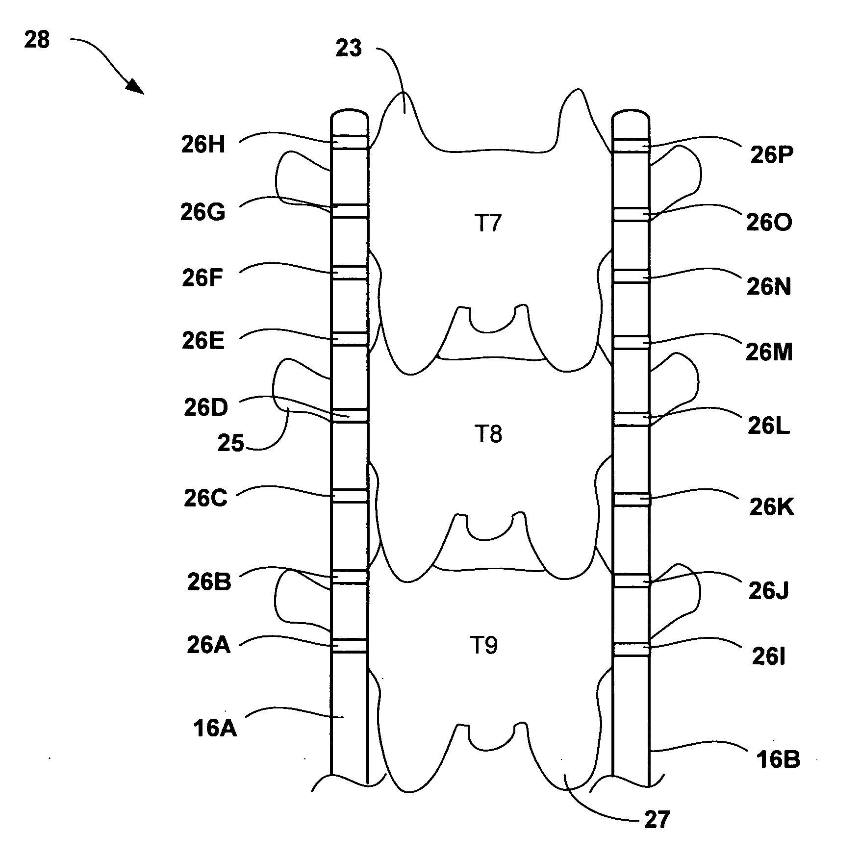 Selection of neurostimulator parameter configurations using genetic algorithms