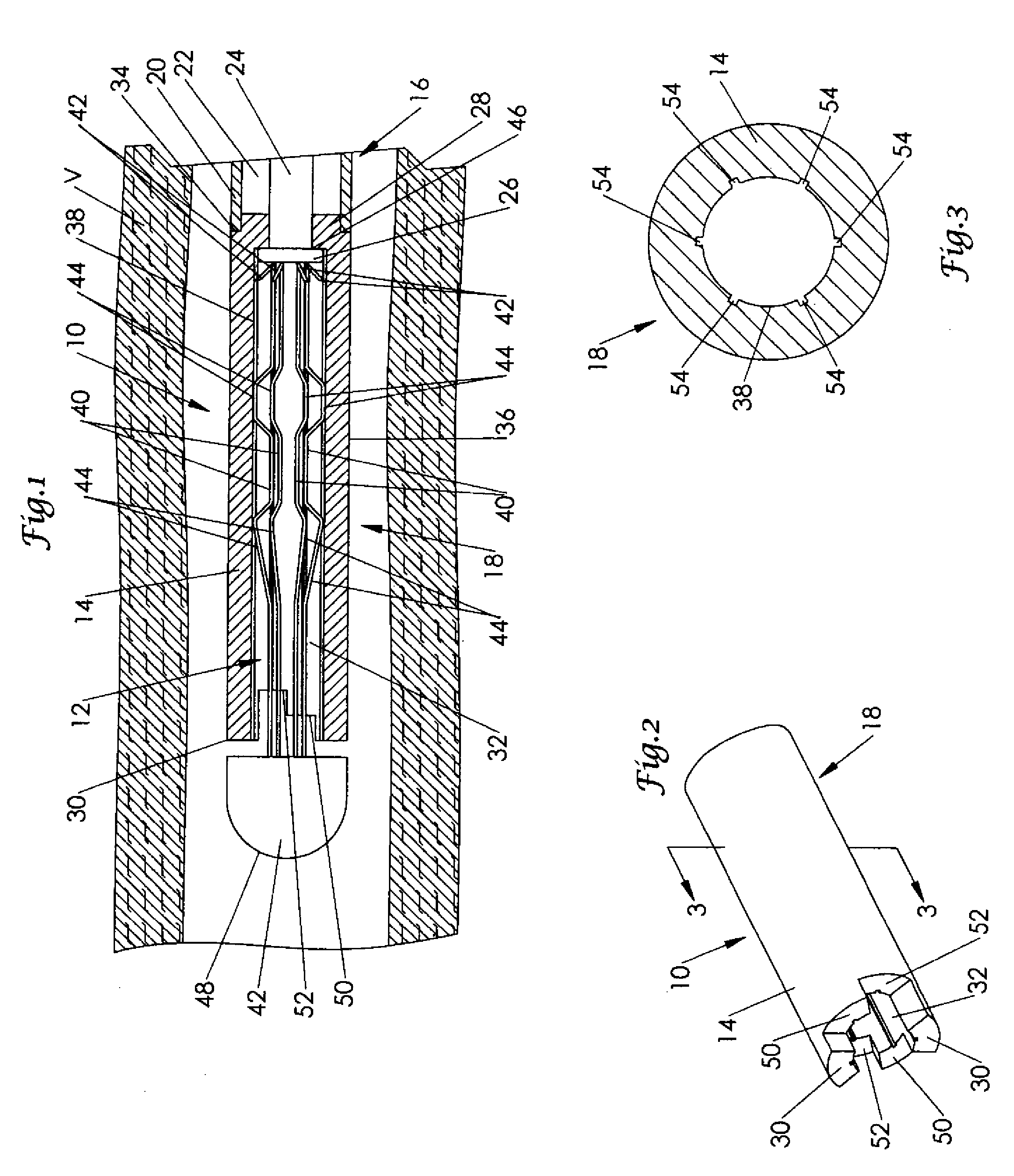 Staged release of IVC filter legs