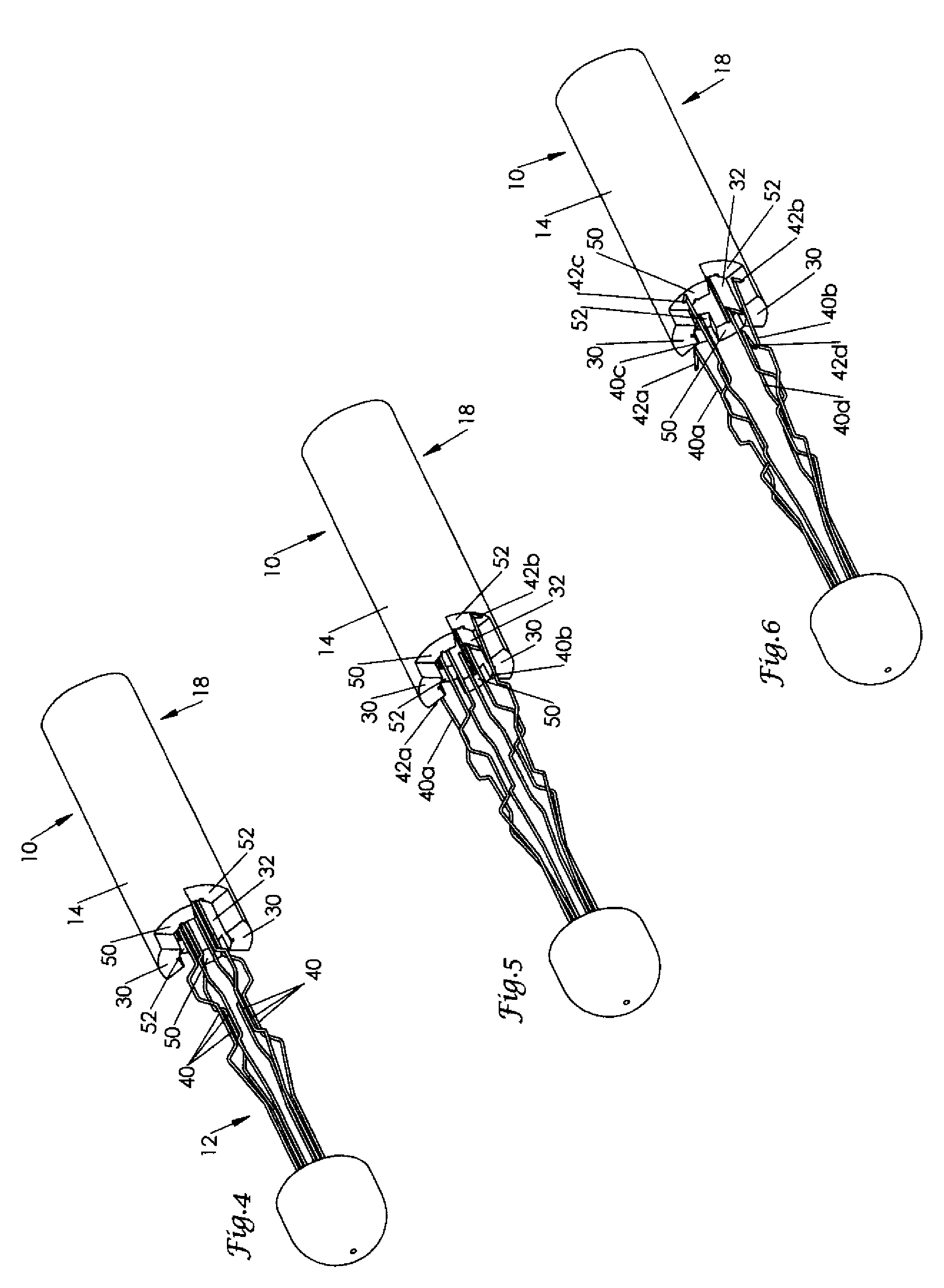 Staged release of IVC filter legs