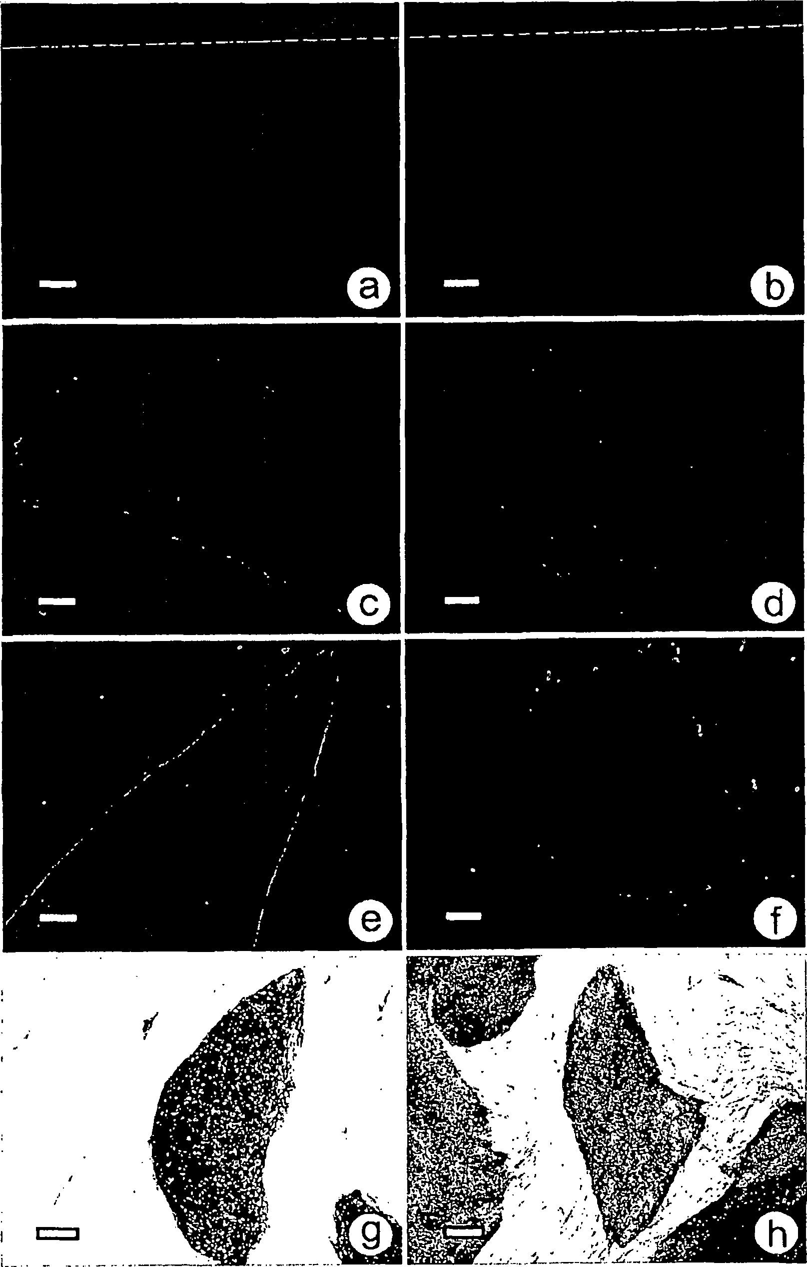 Culture system and method for propagation of human blastocyst-derived stem cells